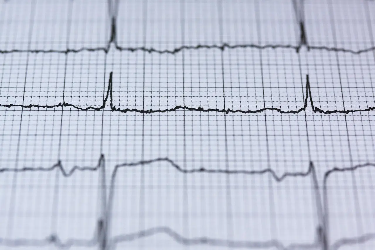 Tracé d'électrocardiogramme sur papier millimétré, pics de battements nettement visibles